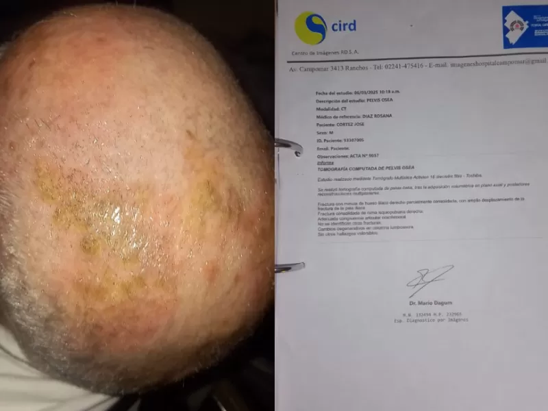 Denuncias por fallos médicos en General Paz