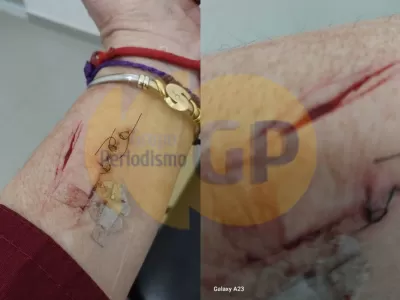 Militante acusa a funcionarios de Tigre por agresión en plena campaña electoral
